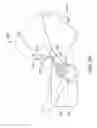 Fig. 18 - METHODS AND DEVICES FOR TREATING MIGRAINES WITH ELECTROMAGNETIC STIMULATION