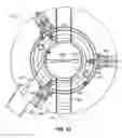 Fig. 15 - Patient positioning system
