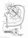 Fig. 01 - Reverse loop ablation device