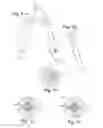 Fig. 04 - Grip exerciser with interchangeable resistance elements