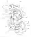 Fig. 01 - Impingement sprinkler