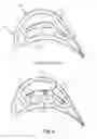 Fig. 02 - Casting of engine parts