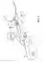 Fig. 03 - Robot arm with high capacity adjustable joint