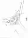 Fig. 05 - Robot arm with high capacity adjustable joint