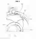 Fig. 06 - Fuel cap integrated aperture type fuel door structure