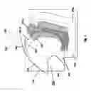 Fig. 02 - Airbag with multi-state vent