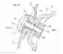Fig. 08 - Exhaust pipe side cover for motorcycle
