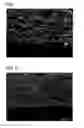 Fig. 07 - Method for producing glass sheet and glass sheet