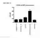 Fig. 31 - ESTER DERIVATIVES OF ANDROGEN RECEPTOR MODULATORS AND METHODS FOR THEIR USE