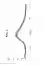 Fig. 03 - Synergistic compositions