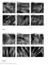 Fig. 04 - Methods and compositions for wound healing