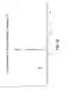 Fig. 16 - SOLID STATE FORMS OF VEMURAFENIB AND VEMURAFENIB SALTS