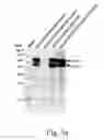 Fig. 04 - Recombinant baculovirus vector and uses thereof