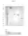 Fig. 16 - ANTIBODIES WITH MODIFIED ISOELECTRIC POINTS AND IMMUNOFILTERING