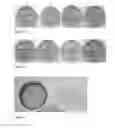 Fig. 04 - Bioprotection using strains