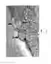Fig. 02 - Methods for compact aggregation of dermal cells