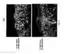 Fig. 20 - Methods for compact aggregation of dermal cells