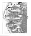 Fig. 30 - Methods for compact aggregation of dermal cells