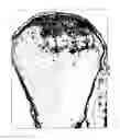 Fig. 32 - Methods for compact aggregation of dermal cells
