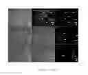 Fig. 06 - Method for culturing skeletal muscle for tissue engineering