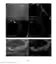 Fig. 10 - Method for culturing skeletal muscle for tissue engineering