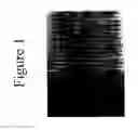 Fig. 02 - DIFFERENTIATION OF ADIPOSE STROMAL CELLS INTO OSTEOBLASTS AND USES THEREOF