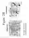 Fig. 04 - DIFFERENTIATION OF ADIPOSE STROMAL CELLS INTO OSTEOBLASTS AND USES THEREOF