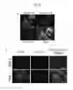 Fig. 03 - Method for inducing alveolar epithelial progenitor cells