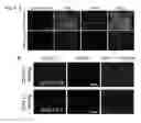 Fig. 05 - Method for inducing alveolar epithelial progenitor cells
