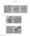 Fig. 15 - Method for inducing alveolar epithelial progenitor cells