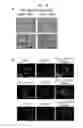 Fig. 16 - Method for inducing alveolar epithelial progenitor cells