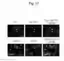 Fig. 18 - Method for inducing alveolar epithelial progenitor cells
