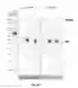 Fig. 45 - RECOMBINANT VIRUS AND PREPARATIONS THEREOF