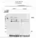 Fig. 47 - RECOMBINANT VIRUS AND PREPARATIONS THEREOF