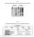 Fig. 07 - Development of Protein-Based Biotherapeutics That Penetrate Cell-Membrane and Induce Anti-Cancer Effect- Cell-Permeable Glutathione Peroxidase7 (CP-GPX7) in Gastrointestinal Track (GIT), Polynucleotides Encoding the Same, and Anti-Cancer Compositions Comprising the Same