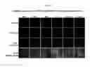 Fig. 10 - Development of Protein-Based Biotherapeutics That Penetrate Cell-Membrane and Induce Anti-Cancer Effect- Cell-Permeable Glutathione Peroxidase7 (CP-GPX7) in Gastrointestinal Track (GIT), Polynucleotides Encoding the Same, and Anti-Cancer Compositions Comprising the Same