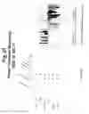 Fig. 22 - Polynucleotides and polypeptide sequences involved in the process of bone remodeling