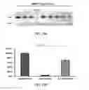 Fig. 26 - SMN2 element 1 antisense compositions and methods and uses thereof