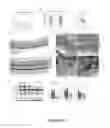 Fig. 12 - Compositions and methods for treating and preventing macular degeneration
