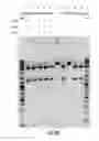 Fig. 28 - COMPOSITIONS AND METHODS OF NUCLEIC ACID-TARGETING NUCLEIC ACIDS