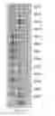Fig. 55 - COMPOSITIONS AND METHODS OF NUCLEIC ACID-TARGETING NUCLEIC ACIDS