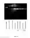 Fig. 31 - Method for pretreatment of microbial samples