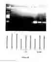Fig. 35 - Method for pretreatment of microbial samples