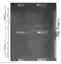 Fig. 09 - Method for Studying V(D)J Combinatory Diversity