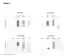 Fig. 04 - PLASMA CELL DISORDERS