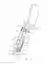 Fig. 03 - Serrated plow blade