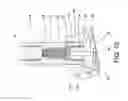 Fig. 11 - Concrete anchor coupling assembly and anchor rod holder