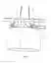Fig. 04 - Method and device for erecting a tower for a wind energy plant
