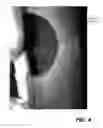 Fig. 06 - TREATMENT OF MICROBIAL-INFLUENCED CORROSION