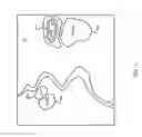 Fig. 14 - In situ gravity drainage system and method for extracting bitumen from alternative pay regions